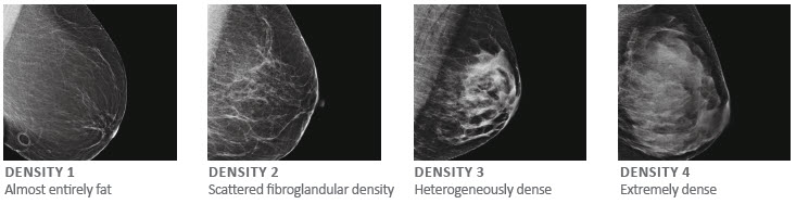 Breast Density Chart